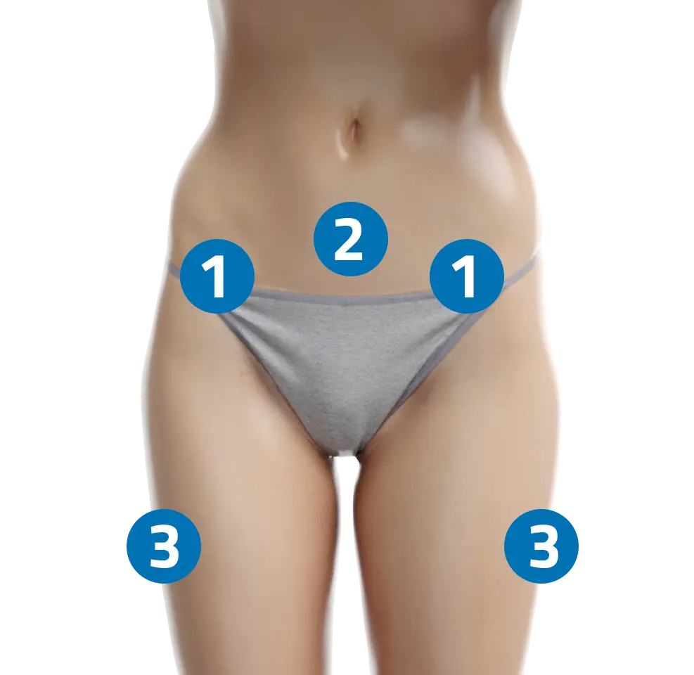 liposuzione adipe addome cosce