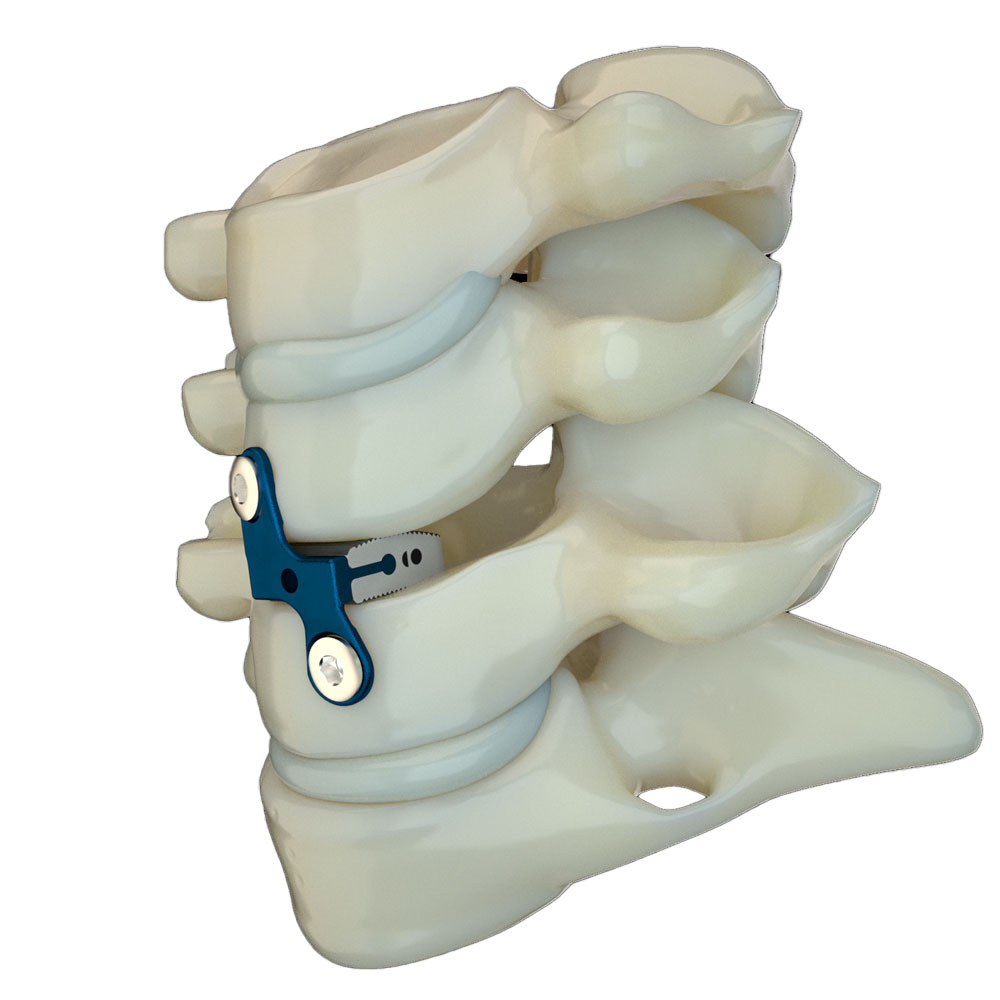 cervical peek spine