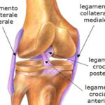lesione tendinea