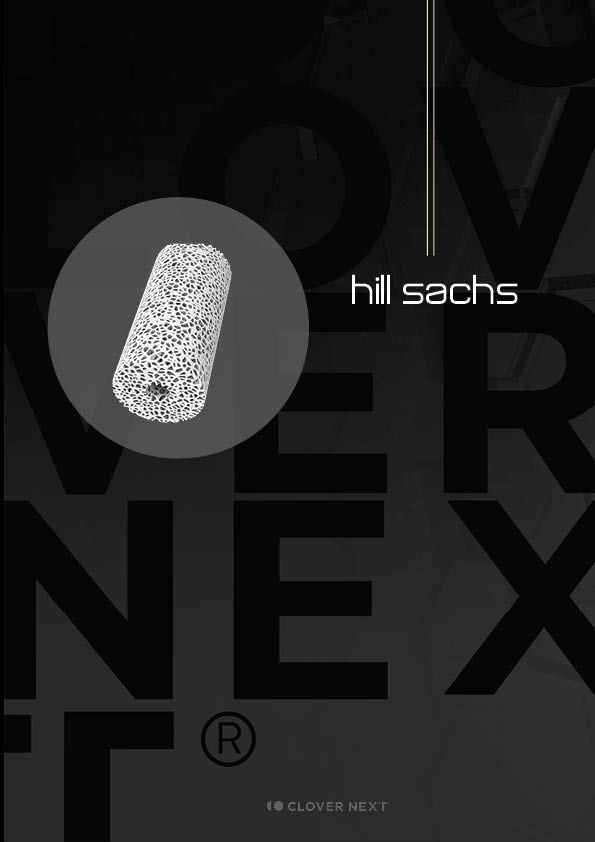 Hill sachs IT 2026
